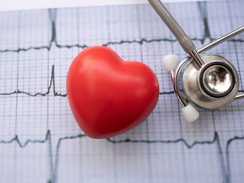 heart-shaped stress ball sitting on a heart rate graph next to a stethoscope