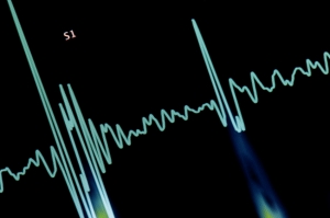 Heart rhythm graphic